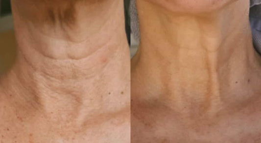 Wagyu Tallow and Stem Cell Moisturizer